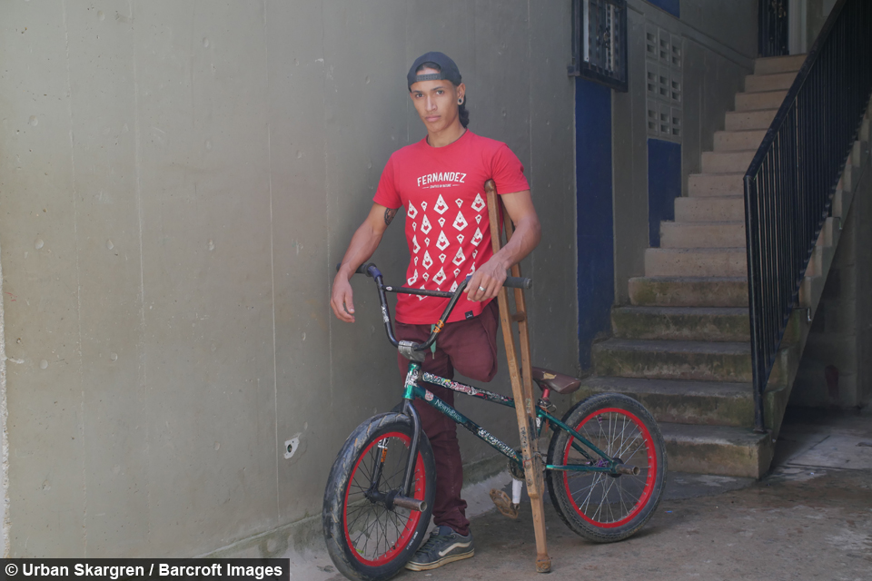 Julian Molina BMX amputee 1